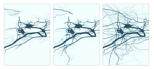 Image showing neuronal network growth in the brain